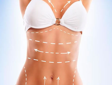 Cirurgia Plástica