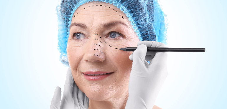 Saiba mais sobre o procedimento de blefaroplastia
