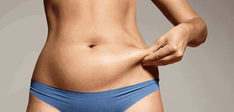 Lipoaspiração em casos de flacidez: saiba tudo