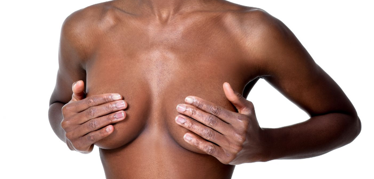 Mamoplastia Redutora: o que você precisa saber